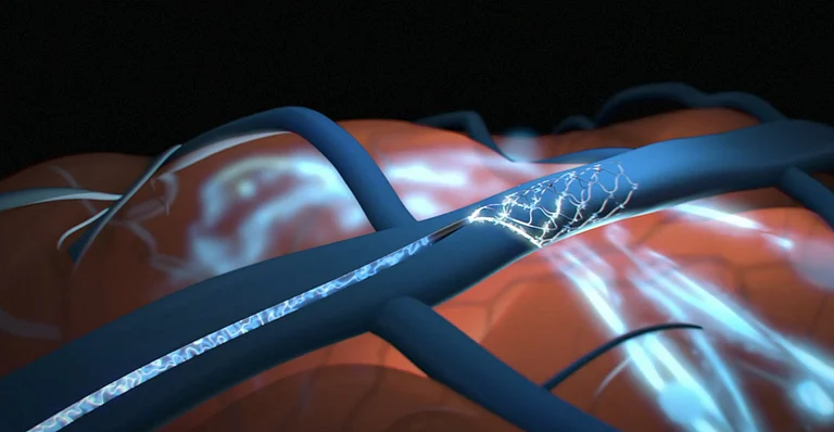 Representative Image - null