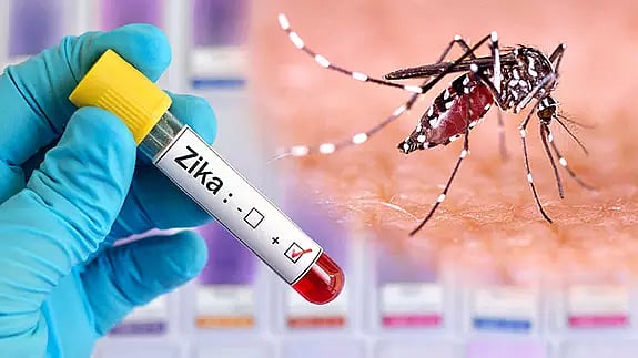 PTI : Union Health Ministry issues advisory on Zika virus.(Representational image) |