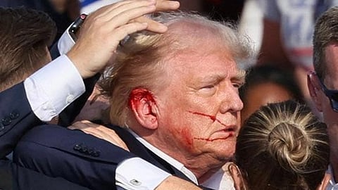 Donald Trump got a bullet through his right ear in Butler Rally shooting.