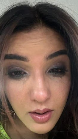 Social media : Jasmin Bhasin Popular TV actor Jasmine Bhasin on Sunday informed she was doing better a day after a major eye injury scare that hit headlines 