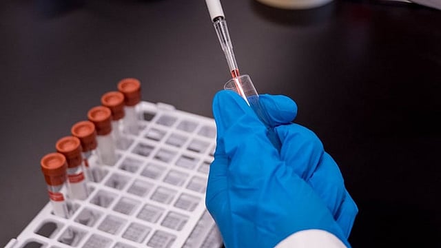 Paris Olympic Games 2024: What Is Blood Doping, Types And Potential Risks?
