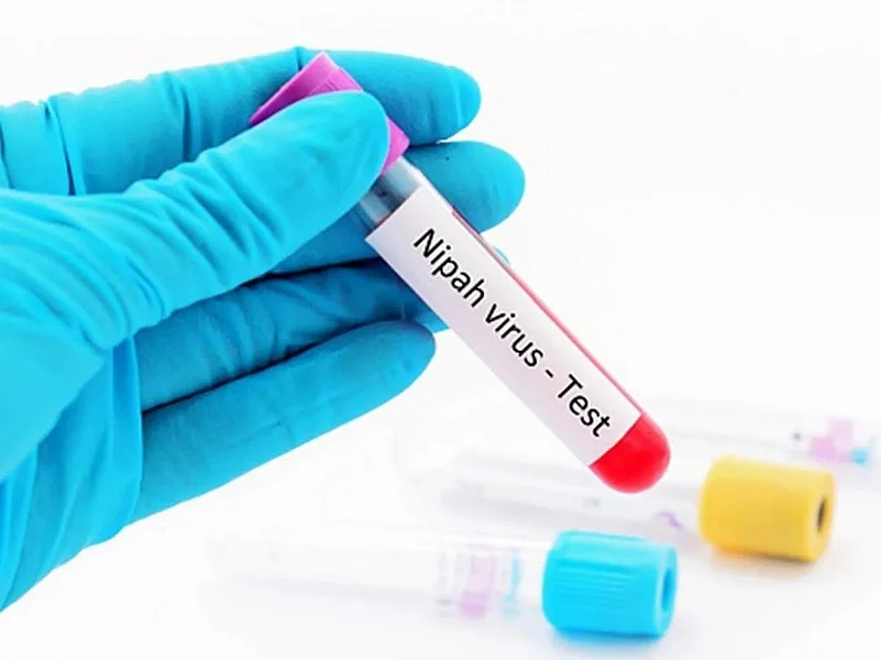 Kerala Nipah virus outbreak.(Representational image) |
