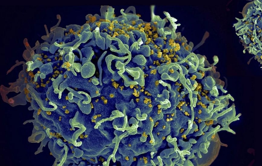 WHO/© S. Pincus, E. Fischer and A. Athman, National Institute of Allergy and Infectious Diseases/NIH : HIV attacks cells that help the body fight infection, making a person more vulnerable to other infections and diseases, even something as regular as a flu.

