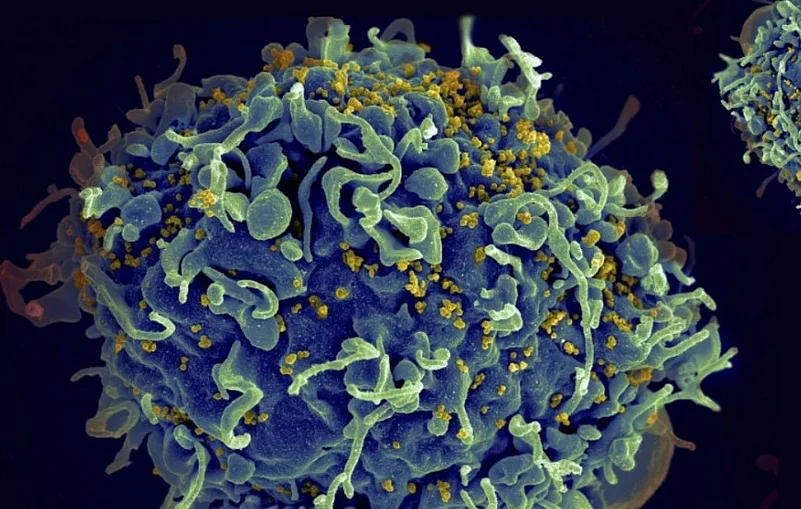 HIV AIDS INDIA