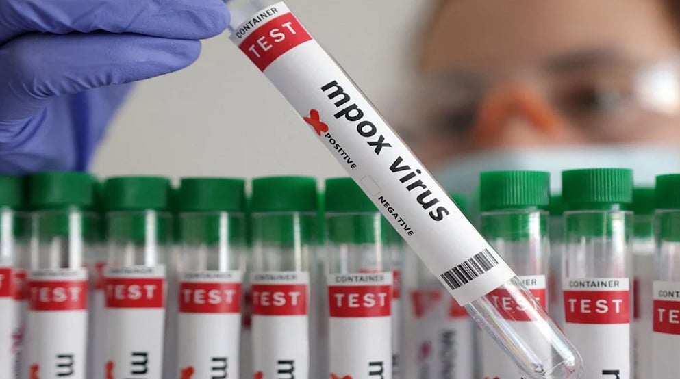 Reuters : Government Issues Advisory To States And UTs On Prevention Of Mpox Spread