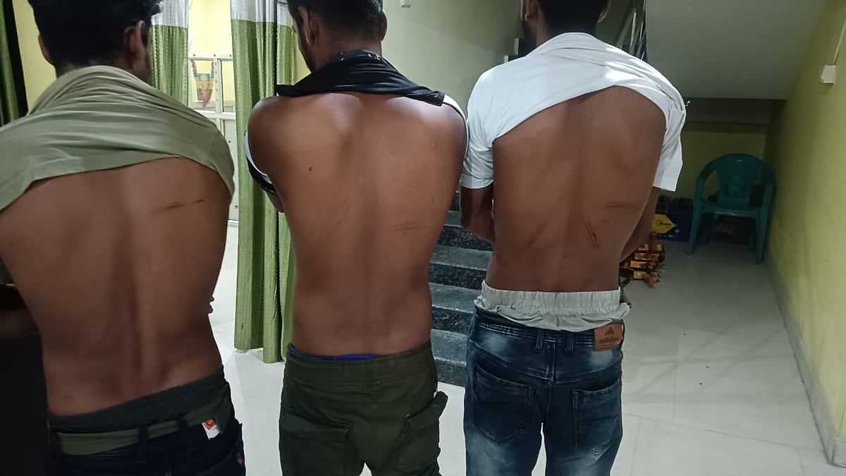 Miya Muslim labourers show marks of beatings.