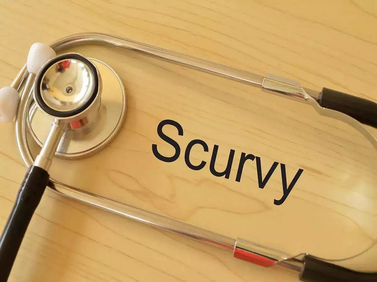 Scurvy Resurgence: Once A Historical Disease, Now Making A Comeback
