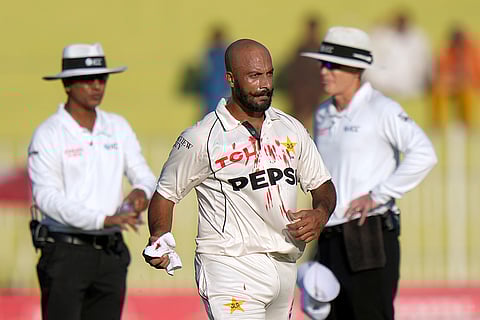 Pakistan vs England 3rd Test: Pakistan's Sajid Khan, center, who is injured when the ball hitting on his face