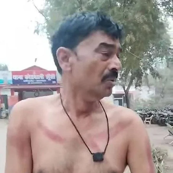 bjp leader assaulted by police