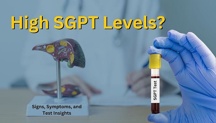 SGPT Levels Demystified: Understanding The Test, Normal Ranges, And What High Levels Mean For Your Liver Health