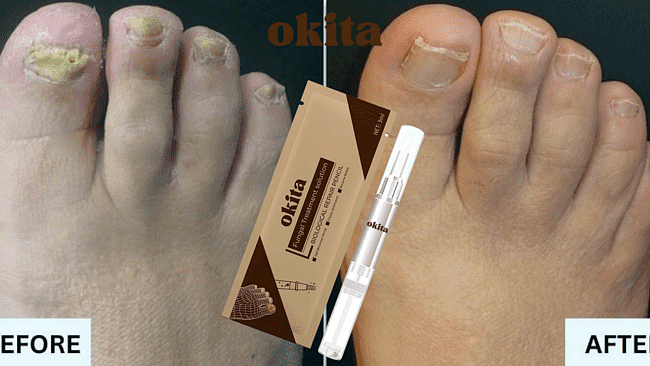 Okita Toenail Fungus Pen Reviews