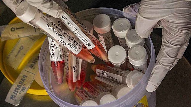 COVID-19 Surge: India Sees Over 3,000 Active Cases, Kerala Leads the Spike