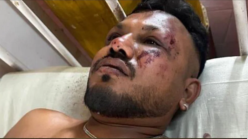 Viswaskumar Ramesh, the sole survivor of the Air India plane crash in Ahmedabad.