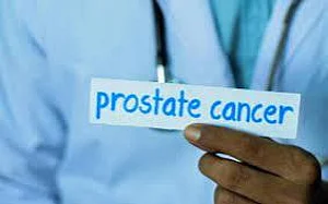 Prostate Cancer