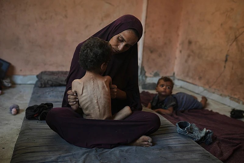 Naima Abu Ful holds her malnourished 2-year-old child, Yazan