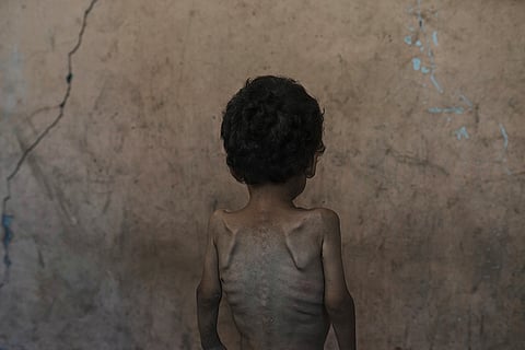 Mideast Wars Dying of Hunger