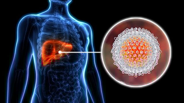 South-East Asia Bears Brunt Of Hepatitis Burden, WHO Urges Action To Eliminate Disease By 2030