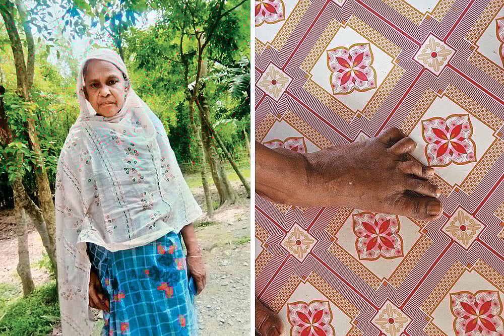 Representative Photo| Forced to Leave: (Left) A photo of Sakina Begum, who has gone missing after her detention; Khatun (name changed) spent two months in Bangladesh after she was pushed back into the country on May 27  - Photos: Arshad Ahmed