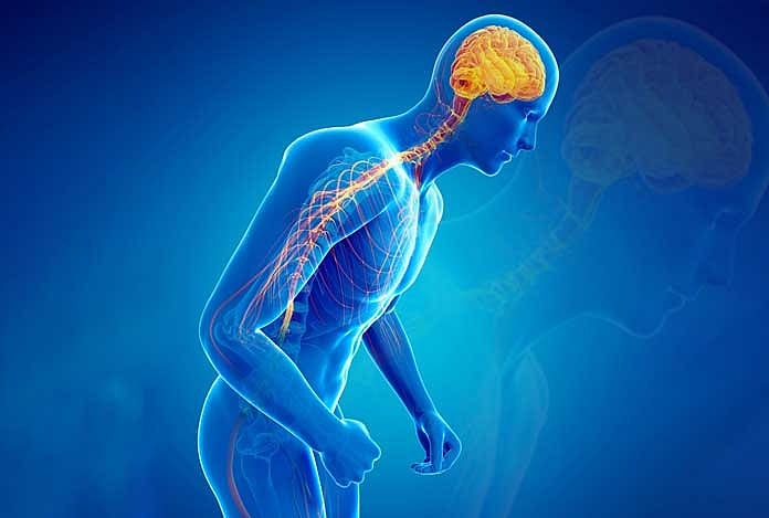 Tiny Gold Particles Offer Hope For Early Detection Of Parkinson’s Disease