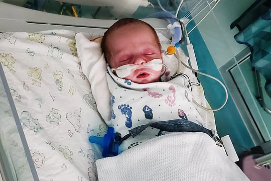 RSV Infections Affect Even Healthy Full-Term Infants: Study