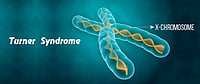 Early Diagnosis Brings Hope To Little Girl With Turner Syndrome