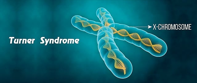 Early Diagnosis Brings Hope To Little Girl With Turner Syndrome