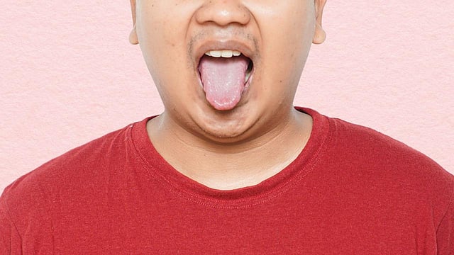 Your Tongue Could Reveal Early Signs Of Motor Neurone Disease, Researchers Discover