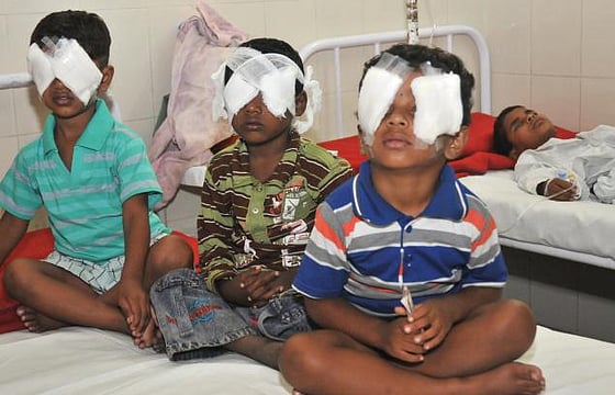 Demand For Firecracker Ban, Safety Measures As Children Suffer Burns; Carbide Guns A New Hazard: AIIMS Experts
