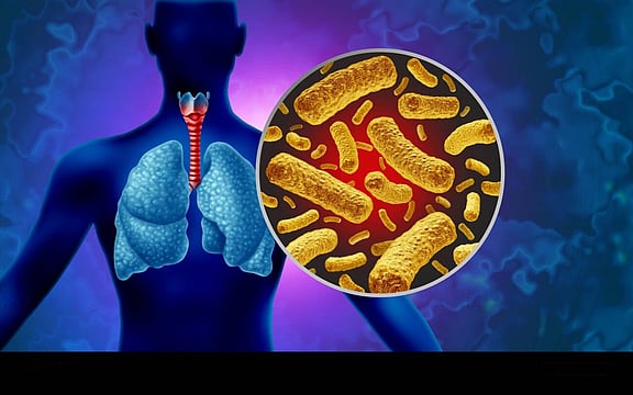 Lesser-Known Bacterium Behind Surge In Children’s Chest Infections In North India: PGIMER