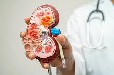 Chronic Kidney Disease Emerging As A Global Health Crisis: Lancet Study