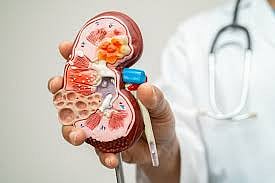 Chronic Kidney Disease Emerging As A Global Health Crisis: Lancet Study
