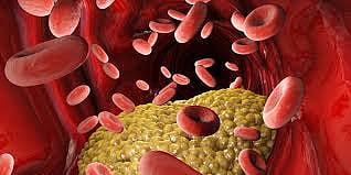 Regular Sugar Monitoring Can Help Prevent Steroid-Induced Diabetes