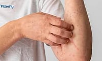 Skin Disorders Can Signal Early Or Uncontrolled Diabetes, Warns Dermatologist Skin Disorders Can Signal Early Or Uncontrolled Diabetes, Warns Dermatologist