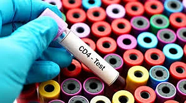 WHO Recommends CD4 Testing To Identify Advanced HIV Disease