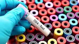 CD4 Test
