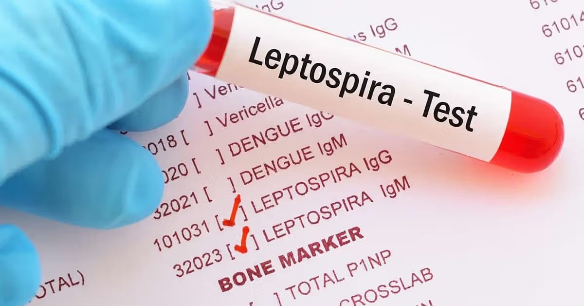 First-Ever Human Leptospirosis Detected In Meghalaya, Researchers Sound Public Health Alarm