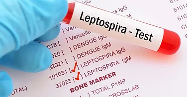 First-Ever Human Leptospirosis Detected In Meghalaya, Researchers Sound Public Health Alarm