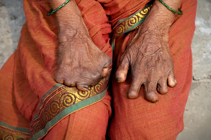 Close-up of weathered hands with visible deformities resting on a red and orange sari