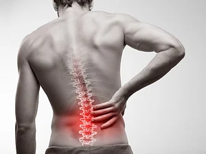 PM-JAY Expands Access To Complex Spine Surgeries, Cuts Out-of-Pocket Costs: Study