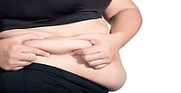 Obesity Raises Risk Of Severe Infection By 70%, Global Study Finds Obesity Raises Risk Of Severe Infection By 70%, Global Study Finds