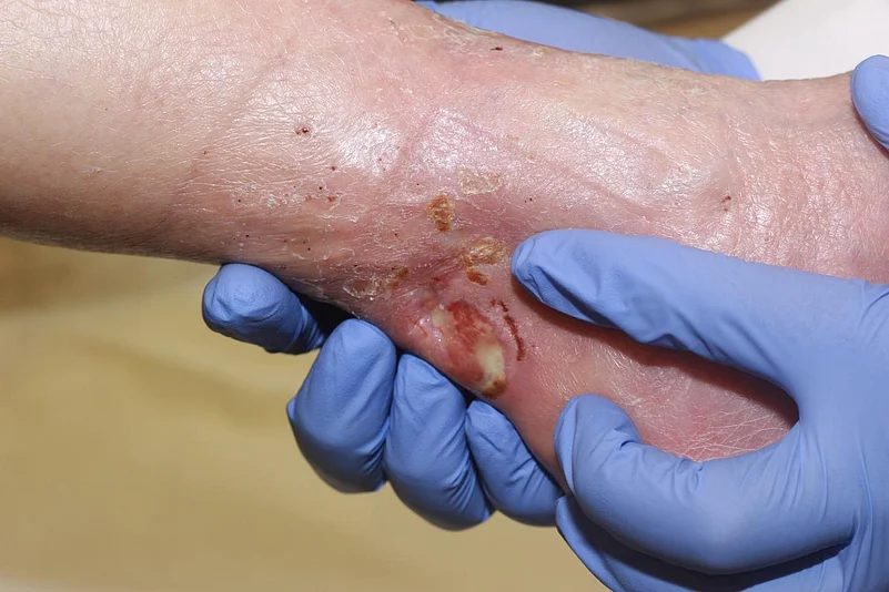 Medical professional examining a wound on leg