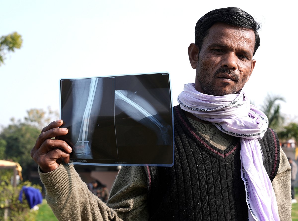 Salim Khan Pathan from Maharashtra at AIIMS 