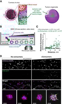 Reimagining The Tumor Battlefield: Advancing Human-Relevant Models In Cancer Metastasis Research