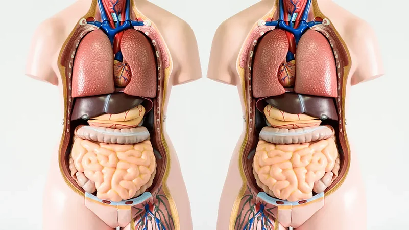 Two models side-by-side showing normal organ placement vs. mirrored situs inversus totalis