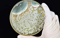 After Bacteria, Experts Warn Of Rising Threat From Drug-Resistant Fungi After Bacteria, Experts Warn Of Rising Threat From Drug-Resistant Fungi
