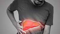 Transplant Success, But Fewer Healthy Donors: Rising Liver Disease Signals Looming Crisis Transplant Success, But Fewer Healthy Donors: Rising Liver Disease Signals Looming Crisis