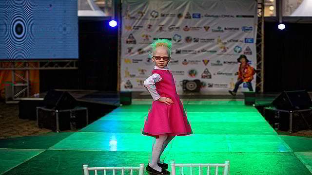 Albino Beauty Pageant