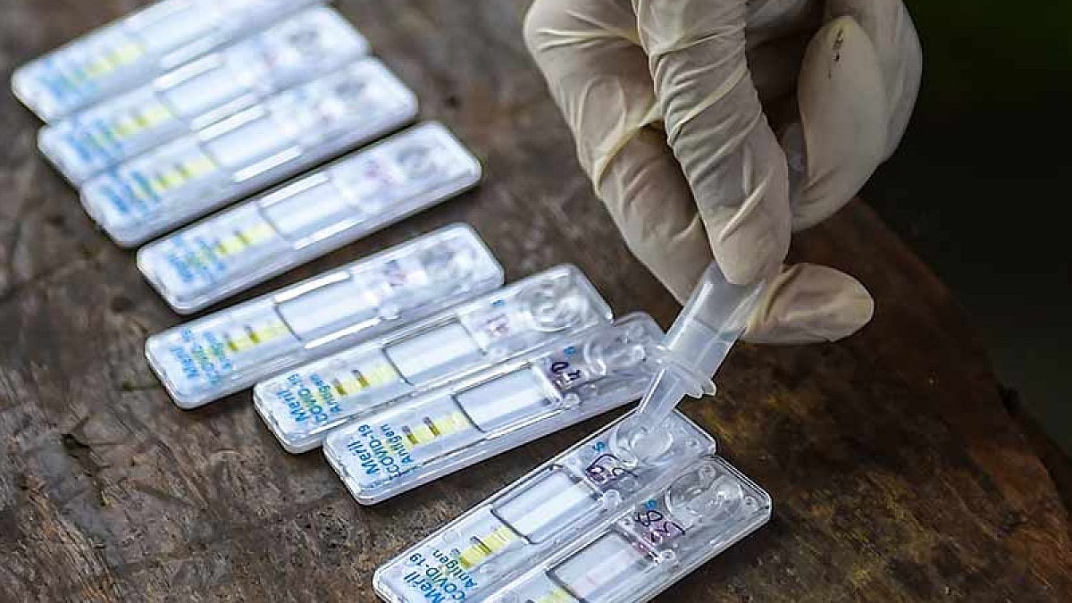 Active Covid-19 cases declined in Odisha.