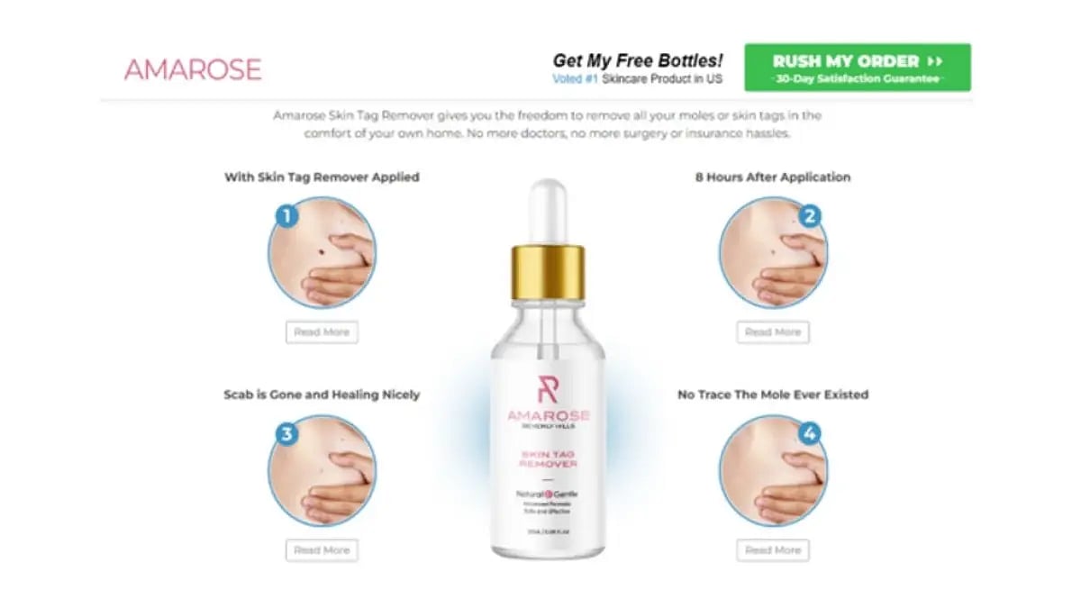 Amarose Skin Tag Remover