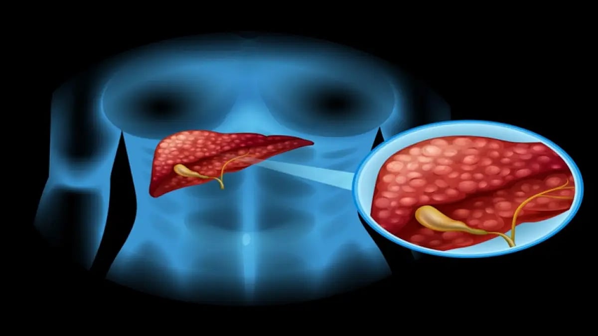 Liver Detox Supplements